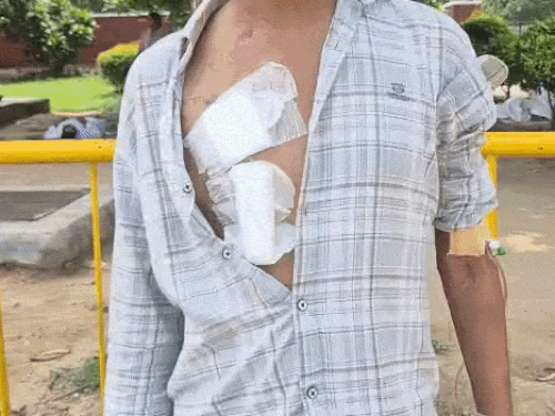 चंडीगढ़- मां ने बेटे को बचाने के लिए किडनी दी:मोहाली में ₹7 लाख का ट्रांसप्लांट फेल, अब मां-बेटे दोनों बीमार; 1 बीघा जमीन भी बिकी 1 whatsappvideo2026 08 13at151956 ezgifcom optimize 1786616558 AGD40H